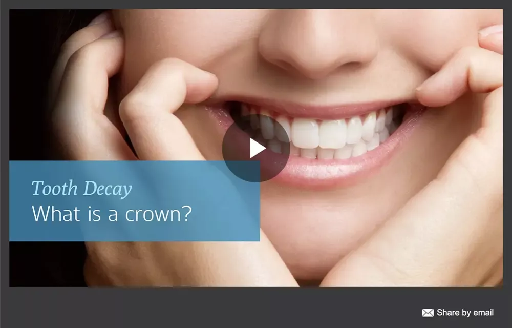 Optio Dentistry video thumbnail